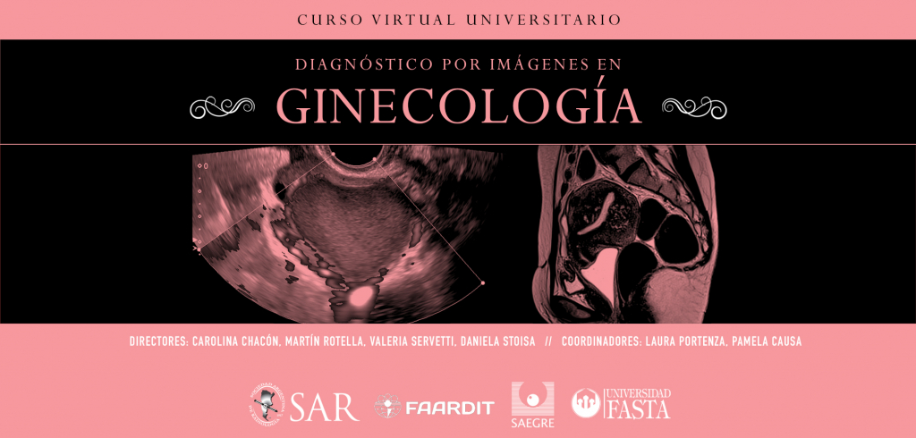 Curso Virtual de Diagnóstico por Imágenes en Ginecología